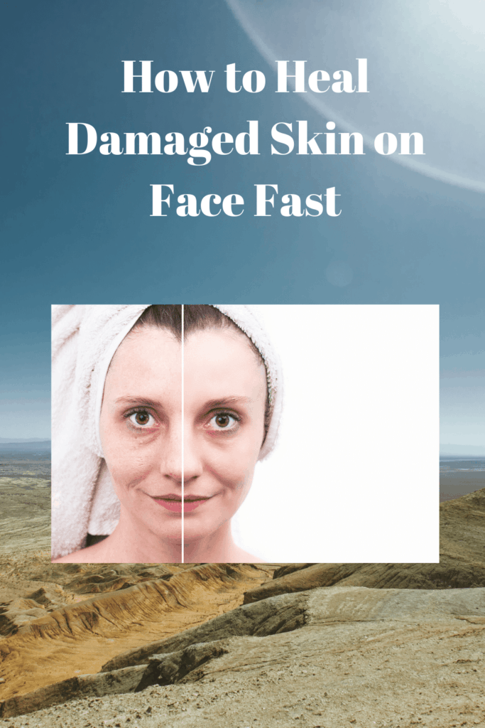 How To Heal Damaged Skin On Face Fast Fast Life Tips