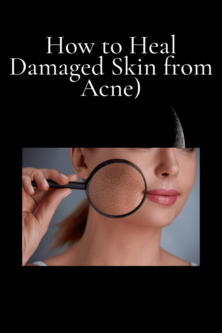 how-to-heal-damaged-skin-from-acne-fast-life-tips